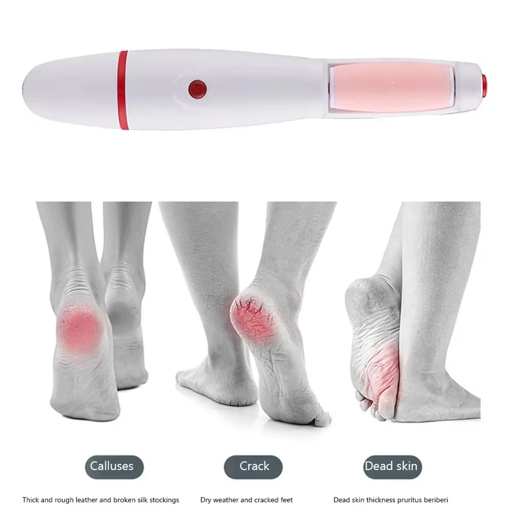 Electric Foot File | Callus & Dead Skin Remover for Pedicures